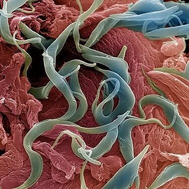 Various parasites living in the human body
