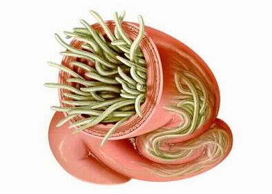 Types of parasites in human body