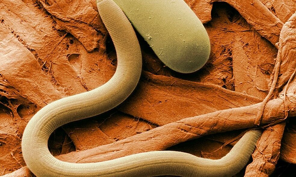 worm parasite from the human body