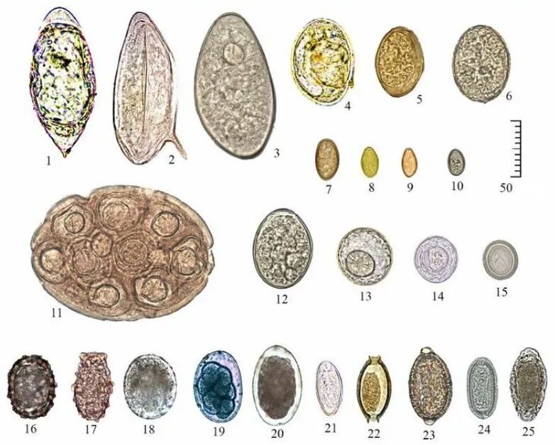 shape and size of eggs of various helminths