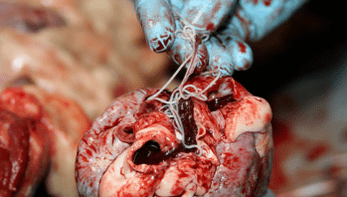 Helimths in the heart