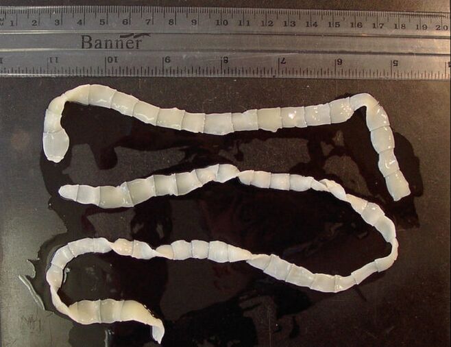 Broad tapeworm